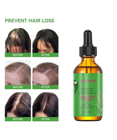 Rosemary Hair Growth Oil & Serum - Dry Scalp Treatment for Women | Hair Thickening & Essential Oil (2OZ) - Boost Hair Growth & Combat Hair Loss - Buy Online on SooperMarket.com
