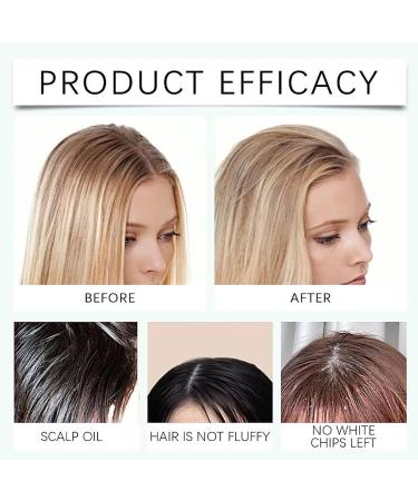 Hair Leave-In Volumizing Styling Spray-Moutew Hair Spray 120 Ml High Cranial Fluffing Spray Leave-In Volumizing Spray Curly Hair Women Volumizing Dry Shampoo Spray Long-Lasting Volume Boost (2 Pack) - Buy Online on SooperMarket.com