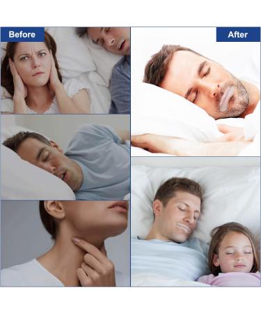 90 PCS Mouth Tape for Sleeping - Anti Snoring Strips for Nasal Breathing - Improve Sleep Quality & Instant Relief - Buy Online on SooperMarket.com