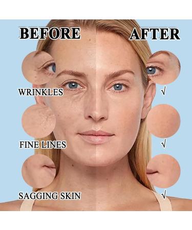 Hyaluronic Acid Serum for Face 95% Hyaluronic Acid & Vitamin C+E - Anti Wrinkle + Anti Aging Hydrochloric Acid Face Serum - Antiaging Hydrating Serums Skincare Dark Spot Remover for Face - Buy Online on SooperMarket.com