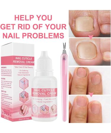 Cuticle Moisturizer | Cuticle Softener & Remover | 1.01fl.oz Natural Softening Instant Quick Absorption Cuticle Cream For Hand Foot & Nail Care Zurego - Buy Online on SooperMarket.com