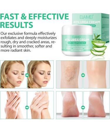 Urea Cream 40 Percent Urea Cream 40 Percent for Feet 150g Urea Cream for Cracked Heels and Dry Skin Deep Moisturizing Nourishing Urea Foot Cream 40 Percent Plus 2% Salicylic Acid - Buy Online on SooperMarket.com