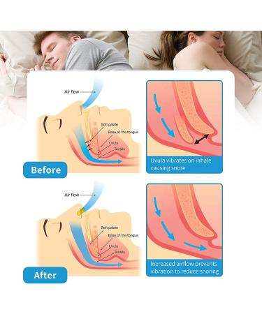 Silicone Magnetic Anti Snoring Nose Clip - Quieter Sleep Solution - Buy Online on SooperMarket.com