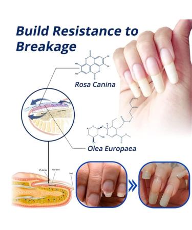7 Days Nail Recovery Growth Essence Pen - Strengthening Serum for Thin Nails | Fast Nail Repair Solution - 1 PC - Buy Online on SooperMarket.com