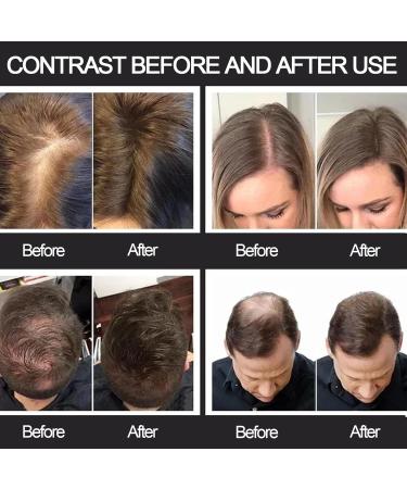 Shop Hair Fibres Black Professional Quality Hair Powder for Thinning Hair | Instant Concealment for Men & Women | No Greasy Residue - Buy Online on SooperMarket.com