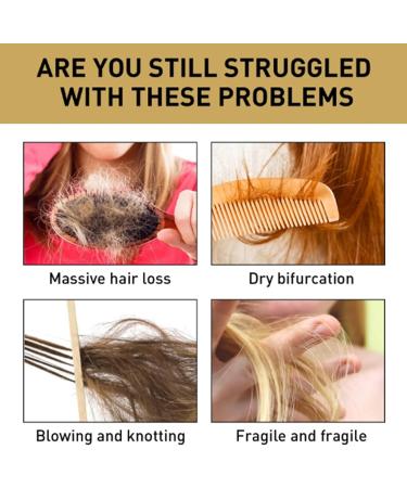 Biotin Shampoo Biotin Shampoo With Volumising Castor Oil Rosemary Oil And Keratin Biotin Shampoo For Dry And Damaged Hair Hair Thickening Treatment For Women & Men With Progressed Thinning - Buy Online on SooperMarket.com