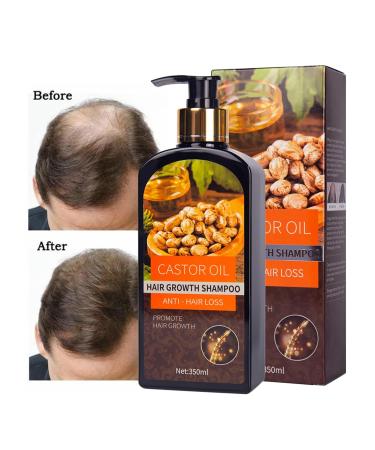 Hair Growth Shampoo with Biotin & Castor Oil | Anti Hair Loss & Hair Thickening | Strengthen & Restore Damaged Hair - 11.8 oz - Buy Online on SooperMarket.com
