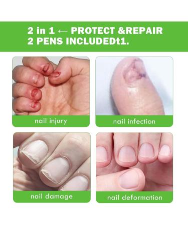 Anti Nail Biting Polish - Nail Biting Prevention for Adults - Stop Nail Biting - Clear Stop Biting Nails Nail Care Bitter Taste Safe Natural Plant Extract - Buy Online on SooperMarket.com