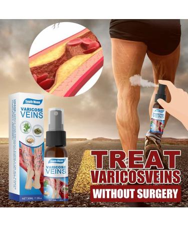 2pcs Veinhealing Varicose Veins Treatment Spray Veinhealing Varicose Veins Spray Vein Healing Varicose Veins Treatment Spray for Legs Varicose Veins Miracle Spray (30ml) - Buy Online on SooperMarket.com