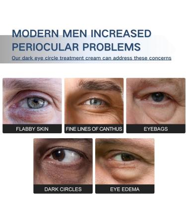 Trendyfave Anti Wrinkle Mens Eye Cream Retinol Eye Cream For Eye Bags & Dark Circles Diminishing Deep Wrinkles And Fine Lines Caffeine Eye Cream Eye Contour Firming Eye Cream - Buy Online on SooperMarket.com