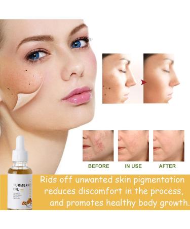 Turmeric Dark Spot Corrector Serum Face Serum for Women Hydrating Serum Serum Face Oils Anti Aging Lightening Brightening Face Serum for Pure Skin Glow Reduce Wrinkles Dark Spots for Body &Face (1PC) - Buy Online on SooperMarket.com