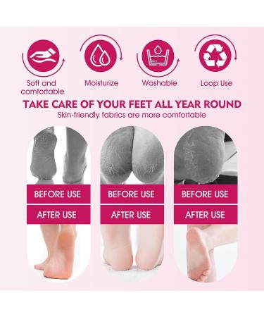 Silicone Socks for Feet - Anti-Slip Moisturizing Foot Mask (4 Pack) + 60g Foot Cream - Soothing Care for Cracked Skin - Skin Color & Pink - Buy Online on SooperMarket.com