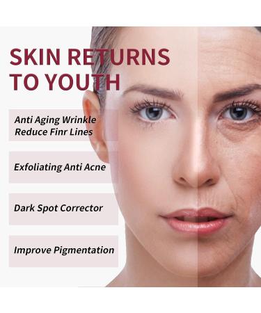 AHA 30% + BHA 2% Peeling Solution - Anti-Acne Serum & Chemical Peel for Face | BHA Liquid Exfoliant for Blemishes & Wrinkles - 1 Floz - Buy Online on SooperMarket.com
