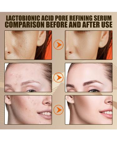 Lactobionic Acid Pore Refining Serum - Shrink Pores Remove Blackheads Reduce Fine Lines & Wrinkles - Anti-Aging Facial Essence 30ml for All Skin Types - Buy Online on SooperMarket.com