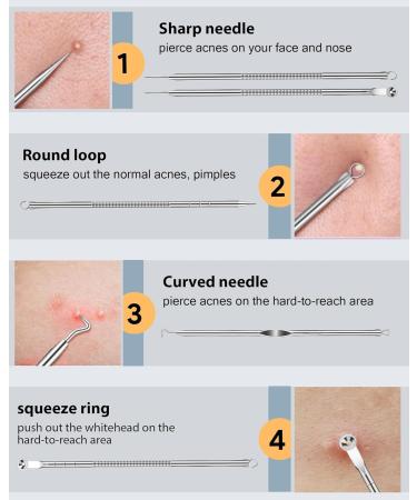 Black Head Remover Tools Blackhead Pore Vacuum: Electric Facial Pore Cleaner 3 Suction Levels Rechargeable Pimple Comedone Extractor Skin Care for Face - Buy Online on SooperMarket.com