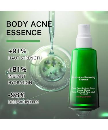 Trendyfave Dark Spot Correcting Glow Serum Skin Tag Removal Age Spot Remover For Face Scar Treatment Pore Minimizer Serums Skincare Contains Tea Tree Oil Vitamin E Body Acne Treatment 30ml - Buy Online on SooperMarket.com