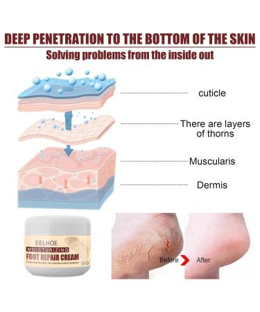 Vegan Foot Cream for Dry Rough & Cracked Feet | Best Callus Care - International Shipping - Buy Online on SooperMarket.com
