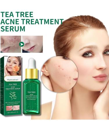 Tea Tree Ance Treatment Serum Tea Tree Oil For Skin Tea Tree Essential Oils Anti-Pimples and Acne Moisturizer and Brighten Skin.Tea Tree Oil for Diffuser Humidifier DIY Home Office 17ml - Buy Online on SooperMarket.com