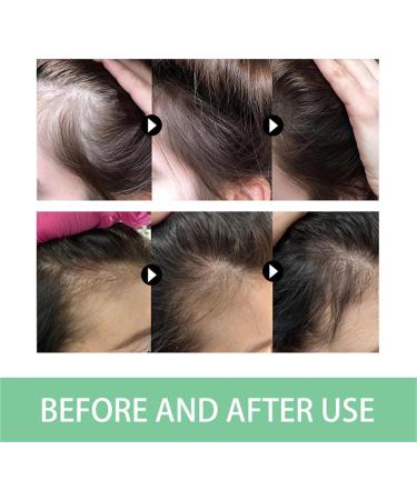 Natural Rosemary Hair Growth Conditioner Biotin Hair Shampoo For Damaged Dry Thinning Hair | Strengthen Hair Soft Hair And Locks In Moisture Nourish Scalp - Buy Online on SooperMarket.com