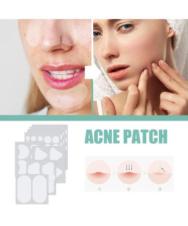 Gentle Solution for Stain Removal | 132 Pimple Spot Treatment for Smooth Skin - Buy Online on SooperMarket.com