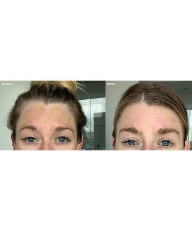 Dark Spot Corrector & Brightening Serum with Kojic Acid, Vitamin C, Salicylic Acid & More | Melasma Treatment Cream by Admire My Skin - Buy Online on SooperMarket.com