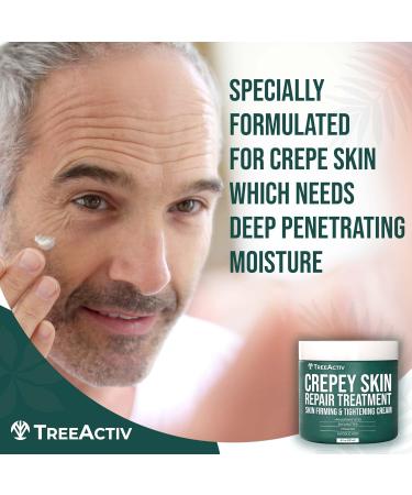 TreeActiv Crepey Skin Repair Treatment with Retinol for Face & Body | Anti-Wrinkle Serum - Buy Online on SooperMarket.com