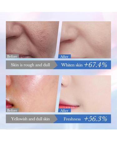 Niacinamide Brightening Face Cream Dry Skin Moisturiser - Whitening Cream for Face Acne Moisturiser Dark Spot Cream Niacinamide Day Cream for Dry Skin Prone to Blemishes - Radiance & Glowing Skin - Buy Online on SooperMarket.com
