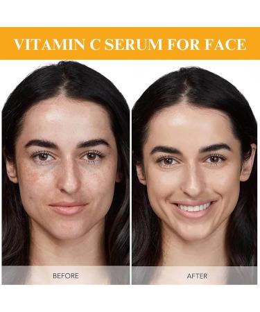 Trendyfave 20% Vitamin C Serum For Face Vitamin C Serum With Hyaluronic Acid Vit C Serum Face Hydrating Face Serum Hydrating & Plump Skin 2FL.OZ - Buy Online on SooperMarket.com