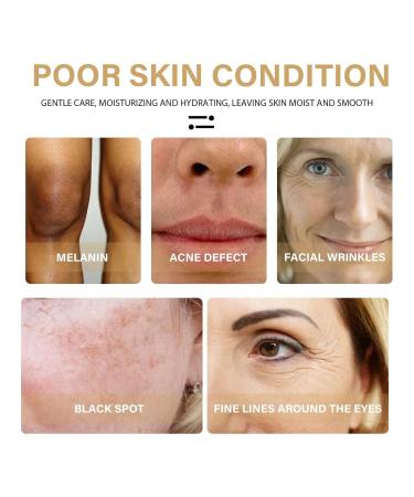 2 Pack Turmeric Dark Spot Corrector Serum - Natural Face Serum for Dark Spots Moisturizing & Repair (30ml) | Best Skin Care Solution - Buy Online on SooperMarket.com