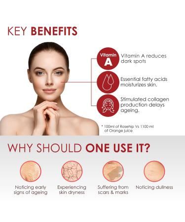 Good Vibes Rose Hip Radiant Glow Face Serum | Lightweight Anti-Aging Moisturizer for All Skin Types | Corrects Dark Spots | 10ml | Paraben & Sulfate Free | Cruelty-Free - Buy Online on SooperMarket.com