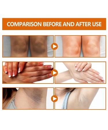 LONGLUAN Fivfivgo Advanced Skin Brightening Serum - Melanosis & Dark Spots Remover - Buy Online on SooperMarket.com