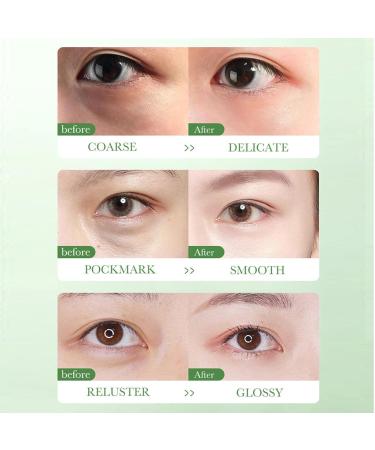 Nourishing Eye Cream with Centella Asiatica Extract Moisturizing Firming Repairing Anti-Wrinkle Centella Asiatica Eye Cream for Dark Circles and Puffy Eyes 20g - Buy Online on SooperMarket.com