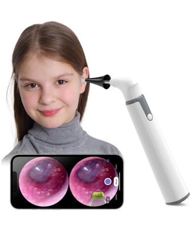 Wireless Otoscope Ear Camera with Dual View 3.9mm 720PHD WiFi Ear Scope with 6 LED Lights for Kids and Adults Compatible with Android and iPhone