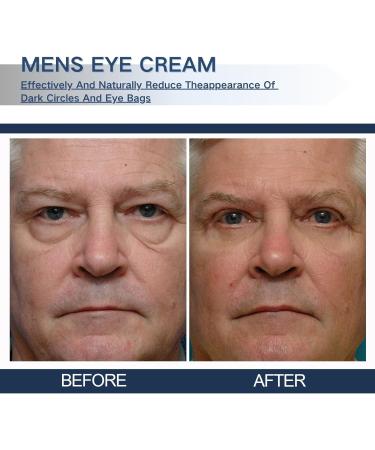 Trendyfave Anti Wrinkle Mens Eye Cream Retinol Eye Cream For Eye Bags & Dark Circles Diminishing Deep Wrinkles And Fine Lines Caffeine Eye Cream Eye Contour Firming Eye Cream - Buy Online on SooperMarket.com