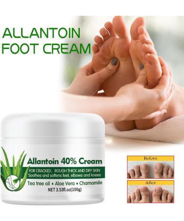 Urea Cream 40 Percent for Feet 40% Urea Cream for Cracked Heels and Dry Skin Aloe Vera Foot Cream with Tea Tree Oil Deep Moisturizing Callus Remover Nourishes Soften for Feet/Knees/Hands/Elbows - Buy Online on SooperMarket.com