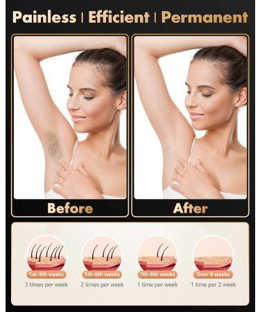 IPL Hair Removal Laser Device for Men & Women - 999 900 Pulses 2 Modes 5 Energy Levels - Painless & Permanent Hair Removal for Body Face & Bikini - Buy Online on SooperMarket.com