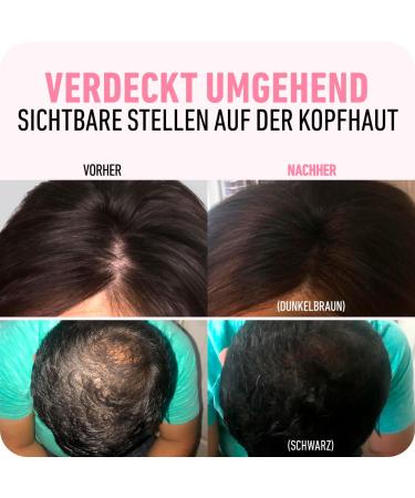 Boldify Approach Powder | Instant Scatter Hair Repair for Thinning & Gray Roots | 48-Hour Formula | Copper Brown 10g - Spread-Free Hair Solution - Buy Online on SooperMarket.com