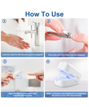 Nail Fungus Treatment Kit - Laser Device for Onychomycosis & Ingrown Toenail - Improves Nail Health with Blue Light - Buy Online on SooperMarket.com