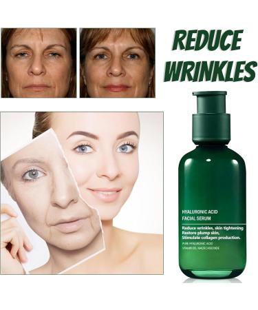 Hyaluronic Acid Facial Serum Hyaluronic Acid Serum Anti Wrinkle Serum Dark Spot Remover for Face Hyaluronic Acid Face Serum for Women Face Moisturiser Skin Tightening Hydrating Plump Skin - Buy Online on SooperMarket.com