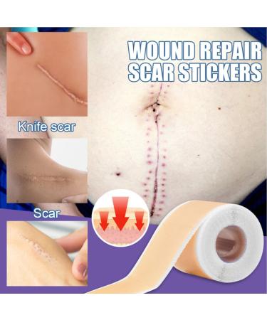 Silicone Scar Tape Roll - Breathable & Painless Moisturizing for Acne Scars Repair - Buy Online on SooperMarket.com