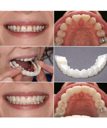 Risely Temporary Whitening Veneers - 2 Pairs of Artificial Teeth for Men & Women | Plug-In Braces & Lightening Dentures - Buy Online on SooperMarket.com