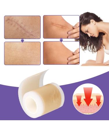 Self-Adhesive Silicone Scar Strips for Acne Scars - Moisturizing & Stretchy Grade A Scar Sheets for Effective Repair - Buy Online on SooperMarket.com