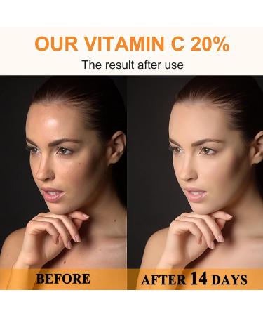 20% Vitamin C Serum for Face with Hyaluronic Acid Reduce Pigmentation for Face Boost Skin Collagen Anti Aging & Wrinkle Facial Serum Brighten Hydrate & Plump Skin Dark Spot Remover for Face - Buy Online on SooperMarket.com