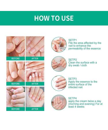Kerassentials Toenail Treatment Oil - 4PCS Natural Nail Treatment for Repairing and Strengthening - Buy Online on SooperMarket.com