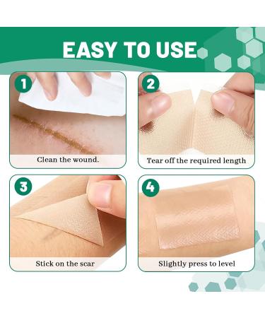 3 Rolls Silicone Scar Sheets(1.6" x 60" Each) Silicone Patches for Scars Reusable Scar Removal Strips for Prevention and Repair - Buy Online on SooperMarket.com