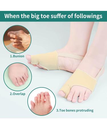 DYKOOK Bunion Corrector & Big Toe Straightener with Heel Strap for Pain Relief - 1 Pair Split Toe Separator for Hallux Valgus Corrector - Non-slip Bunion Protector - Beige (Small) - Buy Online on SooperMarket.com