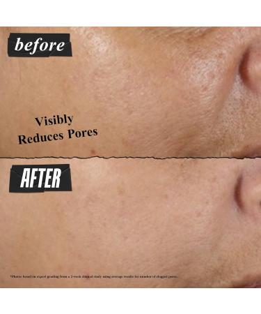 Kiehl's Rare Earth Deep Pore Cleansing Mask 5oz (142g) - International Shipping | Clear Skin & Pore Solutions - Buy Online on SooperMarket.com