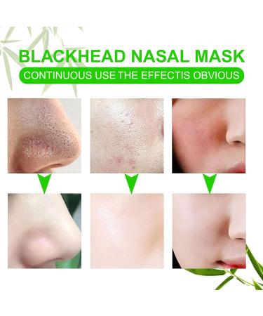 Blackhead Remover Pore Strips 80 Counts Charcoal Deep Cleansing Nose Strips for Blackhead Removal and Pore Unclogging Nose Blackhead Remover Strips Black Head Remover for Women & Men - Buy Online on SooperMarket.com