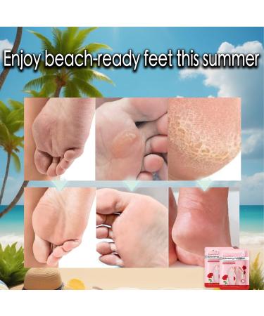 Foot Peel Mask for Hard Skin 2 Pairs Foot Care Foot Moisturiser Exfoliating Sock Hydrating Peeling Foot Mask Foot Exfoliator Foot Masks for Callus Remove Repair Cracked Heel Dead Dry Skin(Rose) - Buy Online on SooperMarket.com