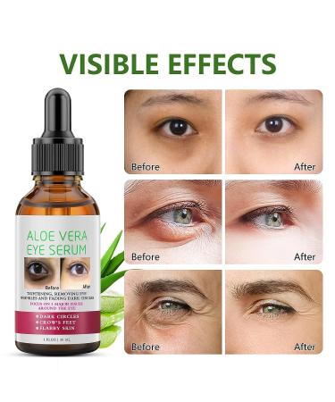 Aloe Vera Anti Aging Eye Serum | Dark Circle & Puffiness Treatment for Women - Buy Online on SooperMarket.com